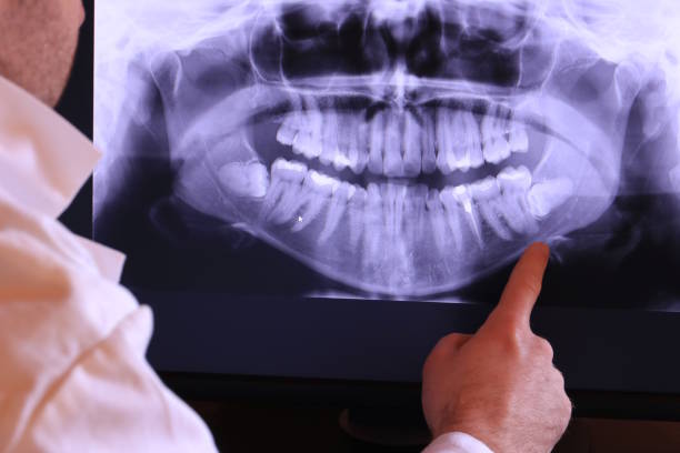 Best Emergency Dentist for Knocked-Out Tooth in Mascot, TN